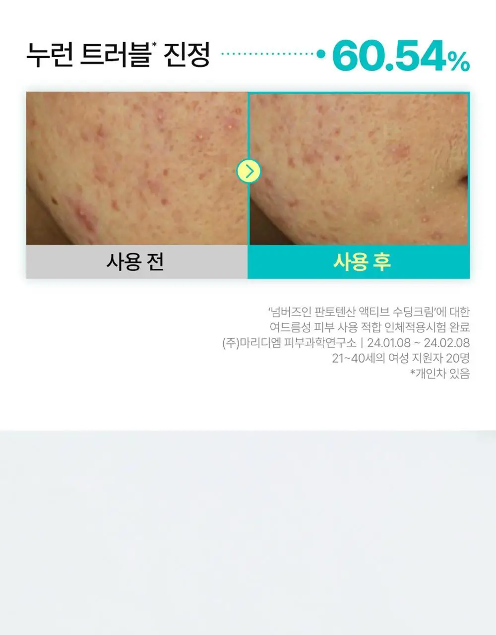 [수분진정][올영단독]넘버즈인 1번 판토텐산 액티브 수딩크림 80ml 1+1 기획 상세페이지 23